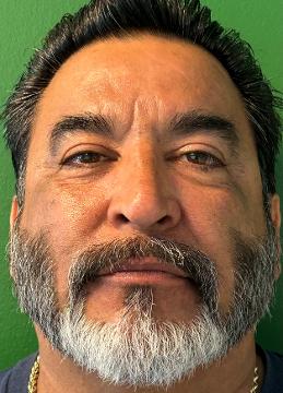 Juan Simental