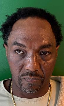 Photo of Lewis, Anthony